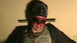 Severe Injuries