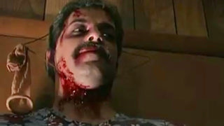 Severe Injuries